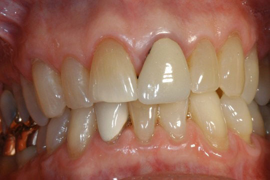 Cosmetic Dentist in San Antonio