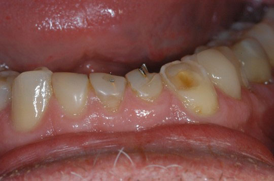 Cosmetic Dentist in San Antonio