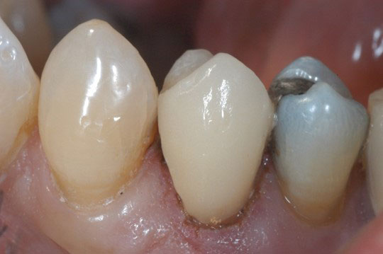 Dentist in Olmos Park