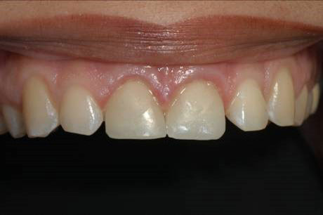 Dentist in Olmos Park