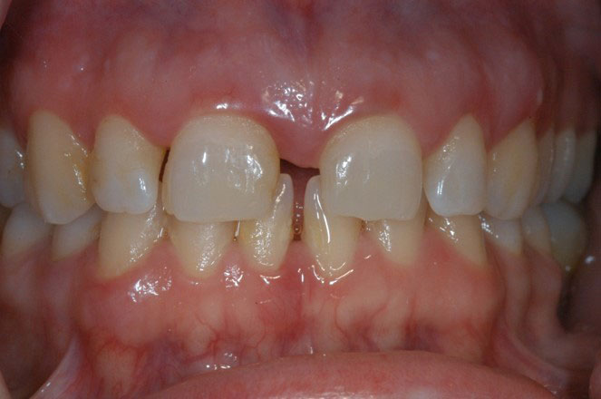 Dentist in San Antonio