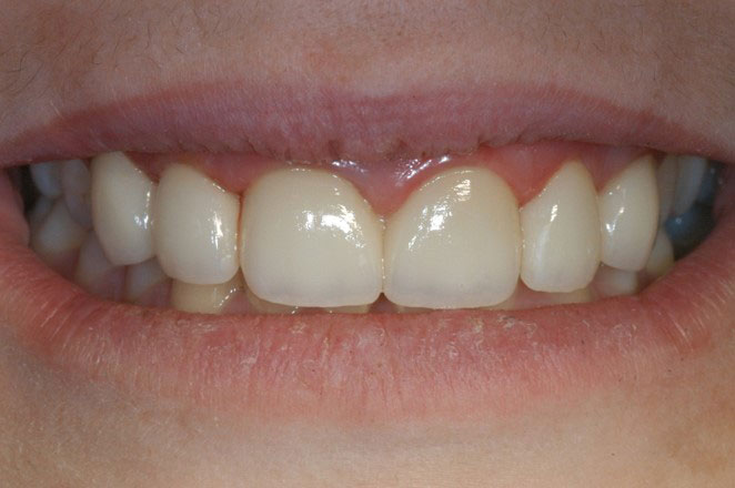 Dentist in Olmos Park