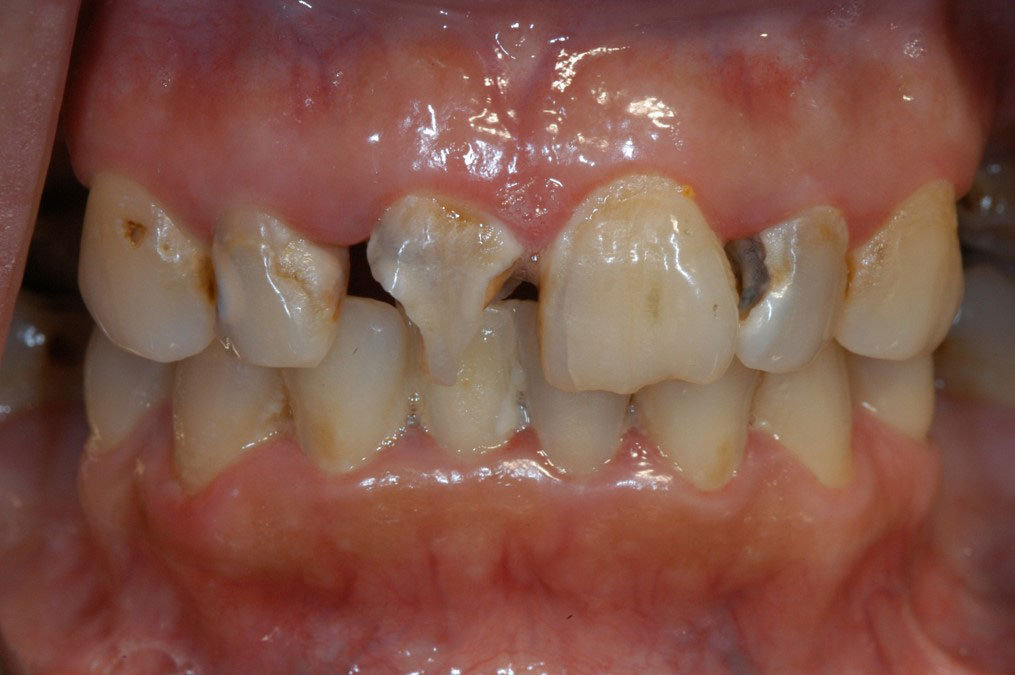 Dentist in San Antonio