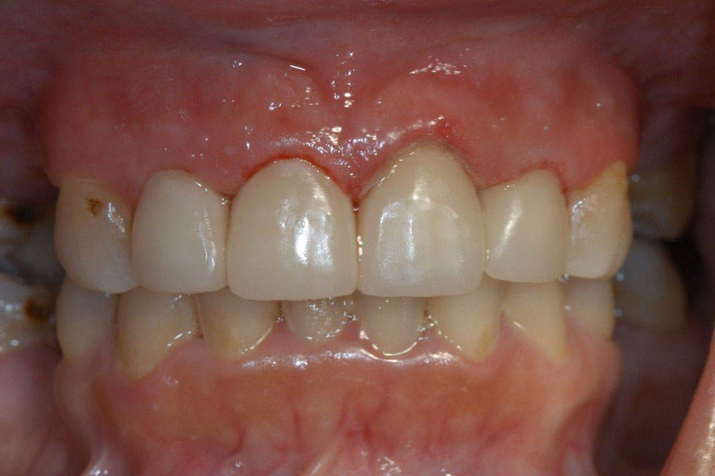 Cosmetic Dentist in Olmos Park